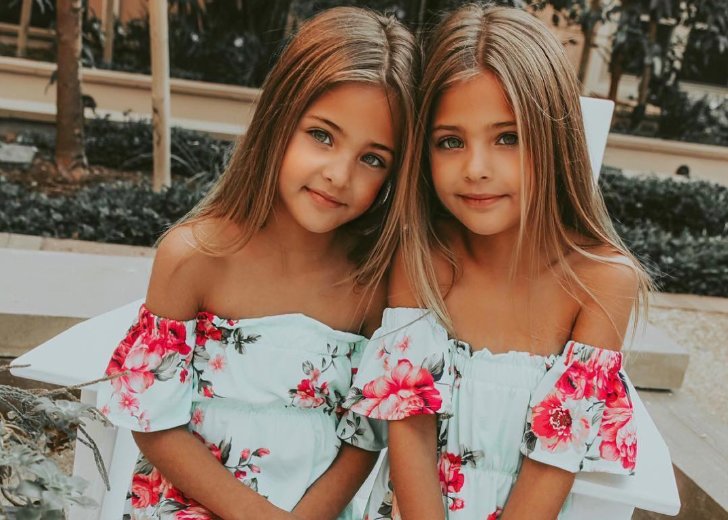 Are These the Most Beautiful Pair of Twins in the World? Net Worth